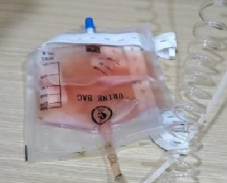 Case sharing | What to do about feline idiopathic cystitis (FIC)?(图19) Case sharing | What to do about feline idiopathic cystitis (FIC)?(图19)